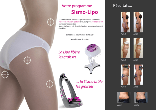 Ouvrir La Franchise Sismo Fitness Dans Le Secteur Beaute Forme